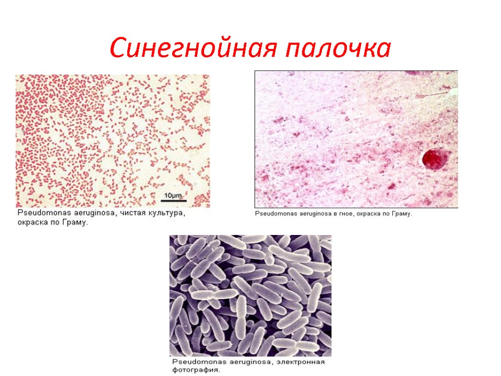 Синегнойная палочка